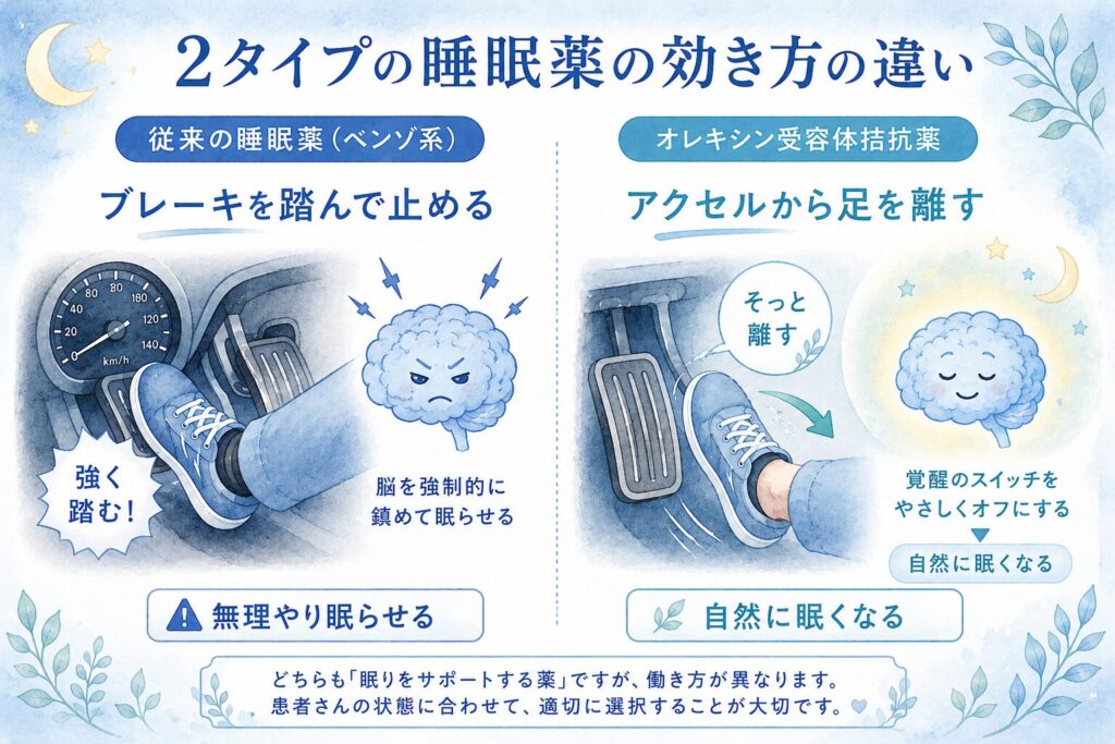 従来の睡眠薬とオレキシン受容体拮抗薬の作用機序の違い。ブレーキを踏む vs アクセルから足を離すの比喩図