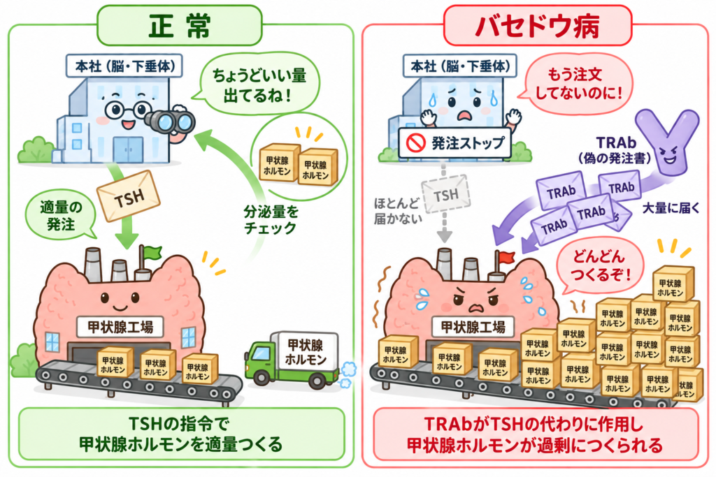 脳の下垂体(本社)がTSH(発注書)で甲状腺(工場)の生産量を調節する正常なしくみと、TRAb(偽の発注書)によって甲状腺が勝手にフル稼働してしまうバセドウ病の違いを、工場に例えて比べたイラスト。